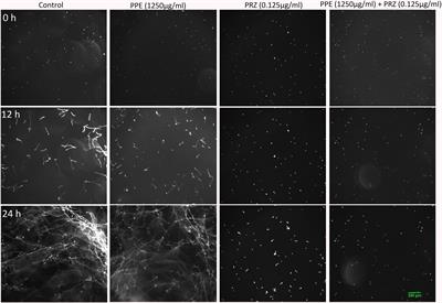 Synergistic Inhibition of Mycotoxigenic Fungi and Mycotoxin Production by Combination of Pomegranate Peel Extract and Azole Fungicide